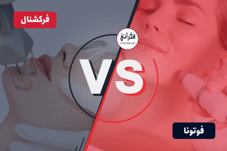 تفاوت لیزر فوتونا و فرکشنال بررسی مزایا و کاربرد تکنولوژی