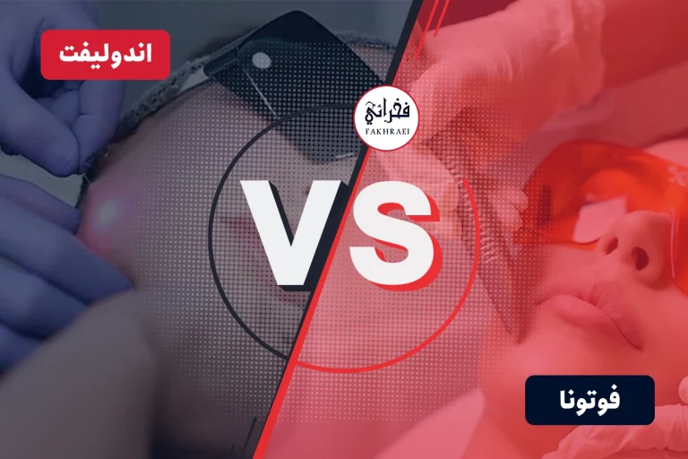 مقایسه لیزر فوتونا و اندولیفت به صورت کامل
