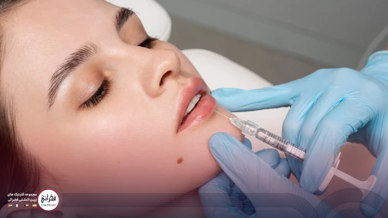 9 مراقبت‌ مهم بعد از تزریق ژل لب : کاهش عوارض و افزایش ماندگاری