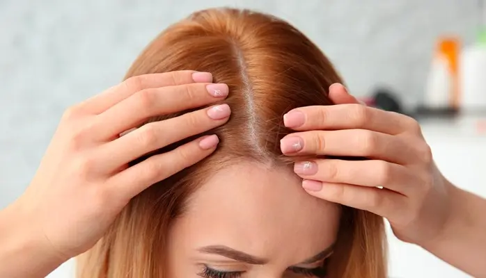 ریشه مو