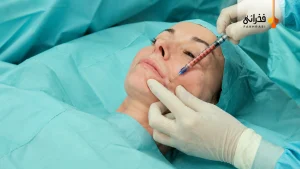 Fat-injection-in-the-smile-line-areas-1